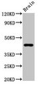 GPR143 Antibody - Positive Western Blot detected in Rat brain tissue. All lanes: GPR14 antibody at 3.7 µg/ml Secondary Goat polyclonal to rabbit IgG at 1/50000 dilution. Predicted band size: 44 KDa. Observed band size: 44 KDa
