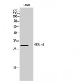 GPR146 Antibody - Western blot of GPR146 antibody
