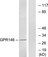 GPR146 Antibody - Western blot analysis of lysates from LOVO cells, using GPR146 Antibody. The lane on the right is blocked with the synthesized peptide.