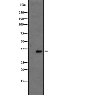 GPR146 Antibody - Western blot analysis of GPR146 expression in A431 whole cells lysate. The lane on the left is treated with the antigen-specific peptide.