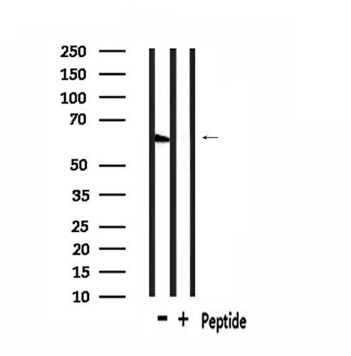 GPR148 Antibody - Western blot analysis of extracts of rat muscle using GPR148 antibody.