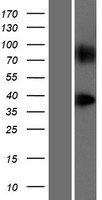 GPR148 Protein - Western validation with an anti-DDK antibody * L: Control HEK293 lysate R: Over-expression lysate