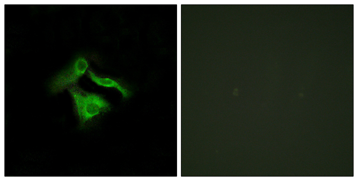 GPR149 / PGR10 Antibody - Immunofluorescence analysis of HeLa cells, using GPR149 Antibody. The picture on the right is blocked with the synthesized peptide.