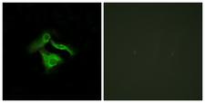 GPR149 / PGR10 Antibody - Immunofluorescence analysis of HeLa cells, using GPR149 Antibody. The picture on the right is blocked with the synthesized peptide.
