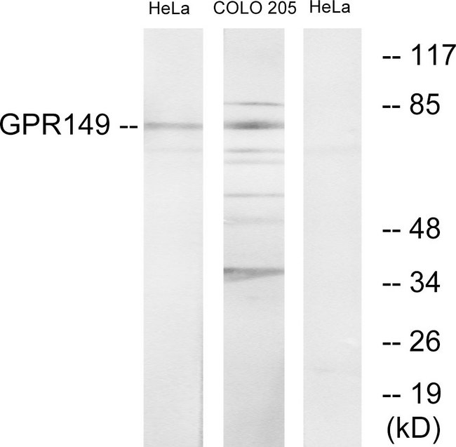 GPR149 / PGR10 Antibody - Western blot analysis of lysates from HeLa and COLO205 cells, using GPR149 Antibody. The lane on the right is blocked with the synthesized peptide.