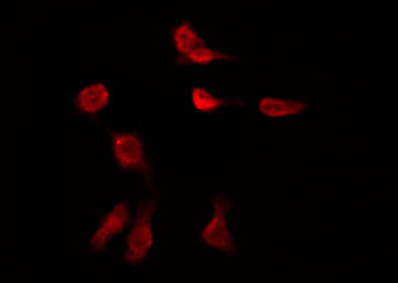 GPR149 / PGR10 Antibody - Staining HeLa cells by IF/ICC. The samples were fixed with PFA and permeabilized in 0.1% Triton X-100, then blocked in 10% serum for 45 min at 25°C. The primary antibody was diluted at 1:200 and incubated with the sample for 1 hour at 37°C. An Alexa Fluor 594 conjugated goat anti-rabbit IgG (H+L) Ab, diluted at 1/600, was used as the secondary antibody.