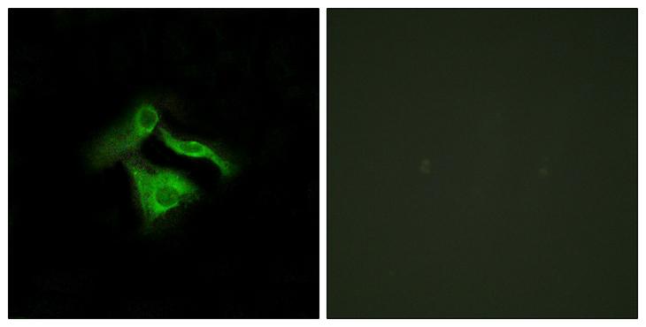GPR149 / PGR10 Antibody - Peptide - + Immunofluorescence analysis of HeLa cells, using GPR149 antibody.