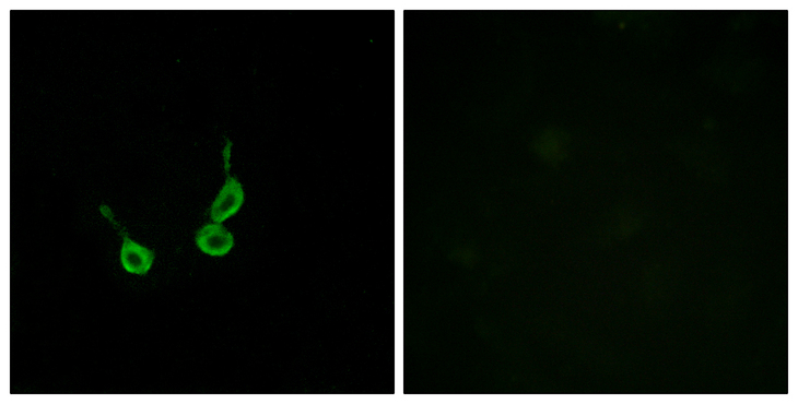 GPR150 Antibody - Immunofluorescence analysis of HepG2 cells, using GPR150 Antibody. The picture on the right is blocked with the synthesized peptide.