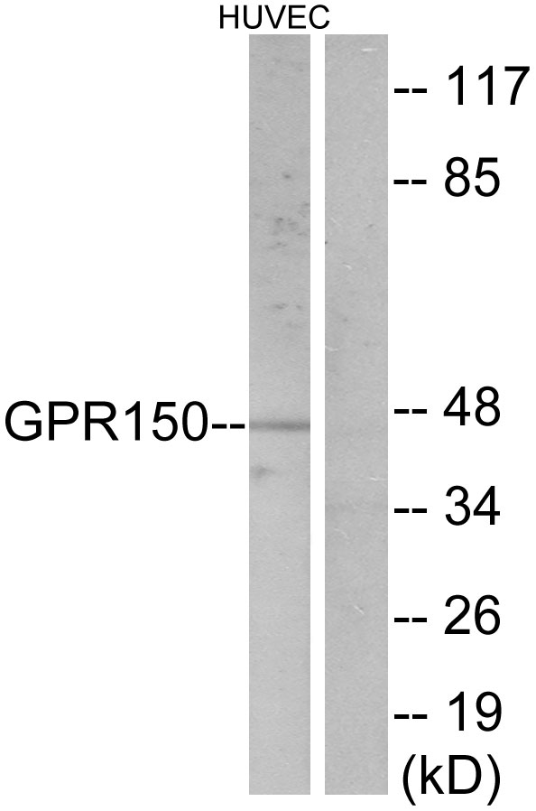 GPR150 Antibody - Western blot analysis of lysates from HUVEC cells, using GPR150 Antibody. The lane on the right is blocked with the synthesized peptide.