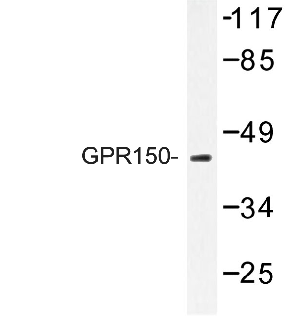 GPR150 Antibody - Western blot of GPR150 (Q391) pAb in extracts from J HUVEC cells.