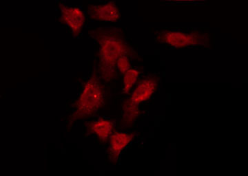 GPR150 Antibody - Staining HuvEc cells by IF/ICC. The samples were fixed with PFA and permeabilized in 0.1% Triton X-100, then blocked in 10% serum for 45 min at 25°C. The primary antibody was diluted at 1:200 and incubated with the sample for 1 hour at 37°C. An Alexa Fluor 594 conjugated goat anti-rabbit IgG (H+L) Ab, diluted at 1/600, was used as the secondary antibody.