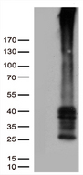 GPR151 Antibody - HEK293T cells were transfected with the pCMV6-ENTRY control. (Left lane) or pCMV6-ENTRY GPR151. (Right lane) cDNA for 48 hrs and lysed. Equivalent amounts of cell lysates. (5 ug per lane) were separated by SDS-PAGE and immunoblotted with anti-GPR151. (1:5000)