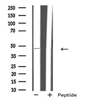 GPR151 Antibody - Western blot analysis of extracts of HuvEc cells using GPR151 antibody.