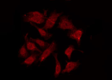 GPR151 Antibody - Staining HuvEc cells by IF/ICC. The samples were fixed with PFA and permeabilized in 0.1% Triton X-100, then blocked in 10% serum for 45 min at 25°C. The primary antibody was diluted at 1:200 and incubated with the sample for 1 hour at 37°C. An Alexa Fluor 594 conjugated goat anti-rabbit IgG (H+L) Ab, diluted at 1/600, was used as the secondary antibody.