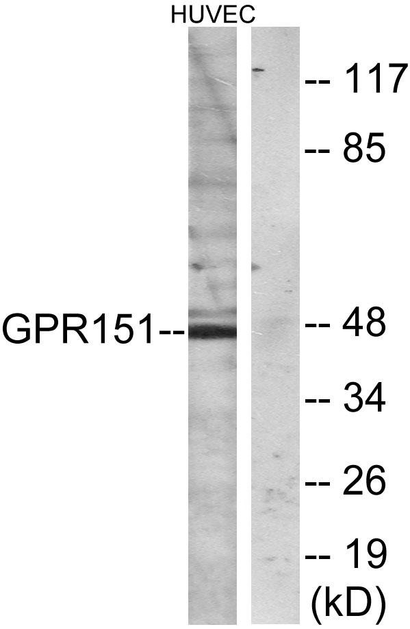 GPR151 Antibody - Western blot analysis of extracts from HUVEC cells, using GPR151 antibody.