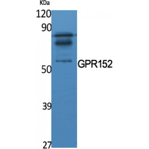 GPR152 Antibody - Western blot of GPR152 antibody