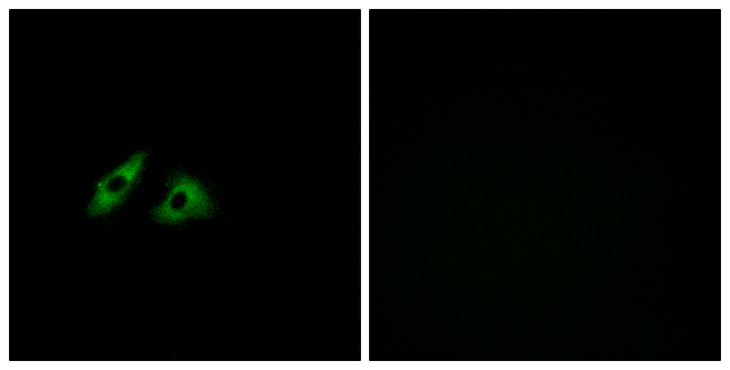 GPR152 Antibody - Immunofluorescence analysis of HeLa cells, using GPR152 Antibody. The picture on the right is blocked with the synthesized peptide.