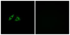 GPR152 Antibody - Immunofluorescence analysis of HeLa cells, using GPR152 Antibody. The picture on the right is blocked with the synthesized peptide.