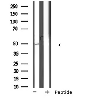 GPR152 Antibody - Western blot analysis of extracts of Jurkat cells using GPR152 antibody.