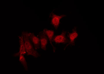 GPR152 Antibody - Staining HeLa cells by IF/ICC. The samples were fixed with PFA and permeabilized in 0.1% Triton X-100, then blocked in 10% serum for 45 min at 25°C. The primary antibody was diluted at 1:200 and incubated with the sample for 1 hour at 37°C. An Alexa Fluor 594 conjugated goat anti-rabbit IgG (H+L) Ab, diluted at 1/600, was used as the secondary antibody.
