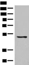 GPR152 Antibody - Western blot analysis of 293T cell lysate  using GPR152 Polyclonal Antibody at dilution of 1:600