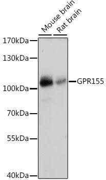 GPR155 Antibody - Western blot analysis of extracts of various cell lines using GPR155 Polyclonal Antibody at dilution of 1:1000.