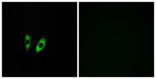 GPR156 Antibody - Immunofluorescence analysis of HeLa cells, using GPR156 Antibody. The picture on the right is blocked with the synthesized peptide.