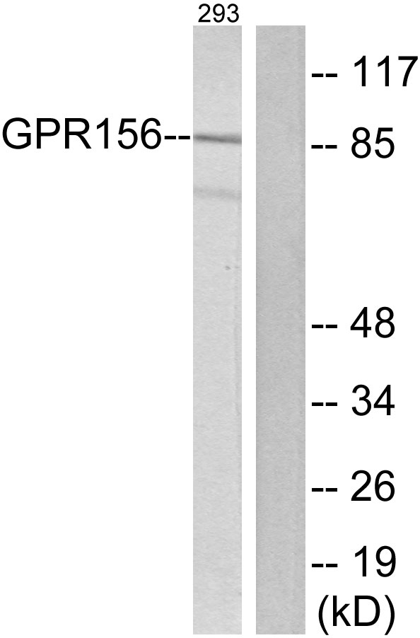 GPR156 Antibody - Western blot analysis of lysates from 293 cells, using GPR156 Antibody. The lane on the right is blocked with the synthesized peptide.