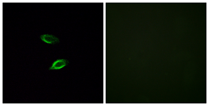 GPR157 Antibody - Immunofluorescence analysis of HUVEC cells, using GPR157 Antibody. The picture on the right is blocked with the synthesized peptide.
