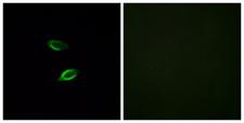 GPR157 Antibody - Immunofluorescence analysis of HUVEC cells, using GPR157 Antibody. The picture on the right is blocked with the synthesized peptide.
