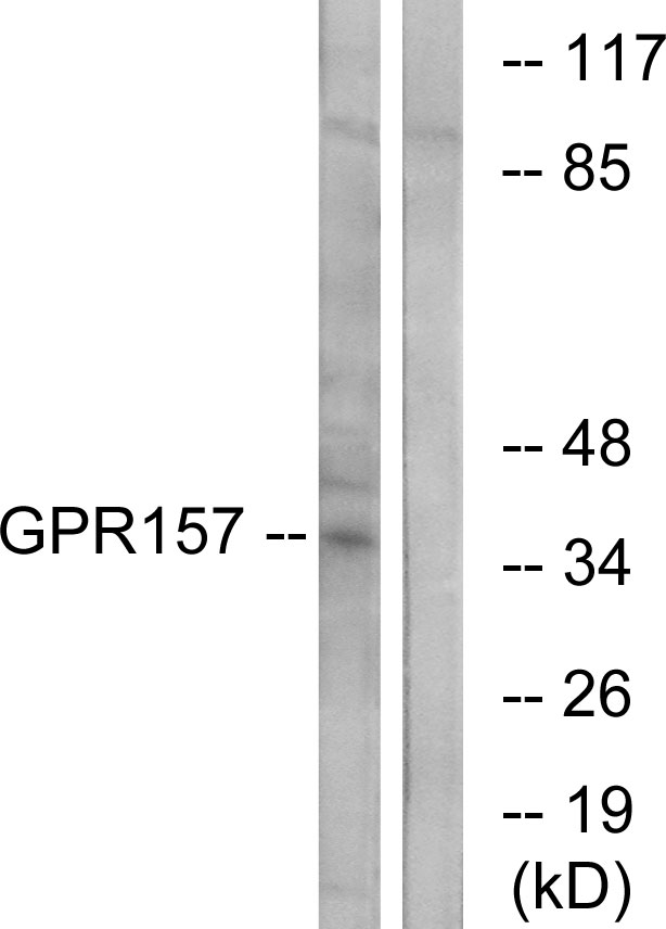 GPR157 Antibody - Western blot analysis of lysates from NIH/3T3 cells, using GPR157 Antibody. The lane on the right is blocked with the synthesized peptide.