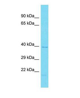 GPR157 Antibody - Western blot of GPR157 Antibody - C-terminal region with human HeLa cells lysate.  This image was taken for the unconjugated form of this product. Other forms have not been tested.