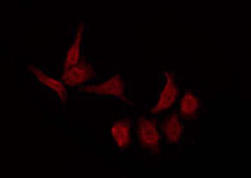 GPR157 Antibody - Staining NIH-3T3 cells by IF/ICC. The samples were fixed with PFA and permeabilized in 0.1% Triton X-100, then blocked in 10% serum for 45 min at 25°C. The primary antibody was diluted at 1:200 and incubated with the sample for 1 hour at 37°C. An Alexa Fluor 594 conjugated goat anti-rabbit IgG (H+L) Ab, diluted at 1/600, was used as the secondary antibody.