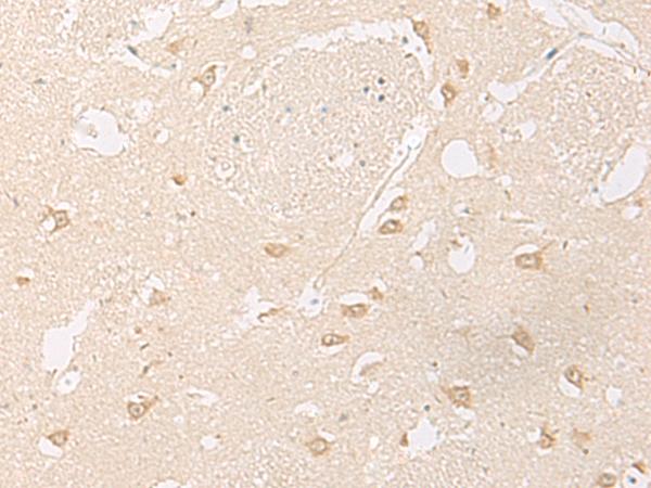 GPR157 Antibody - Immunohistochemistry of paraffin-embedded Human brain tissue  using GPR157 Polyclonal Antibody at dilution of 1:60(×200)