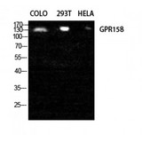 GPR158 Antibody - Western blot of GPR158 antibody