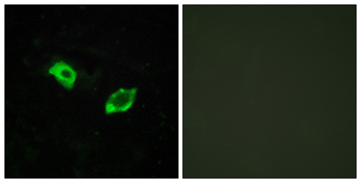 GPR158 Antibody - Immunofluorescence analysis of HUVEC cells, using GPR158 Antibody. The picture on the right is blocked with the synthesized peptide.