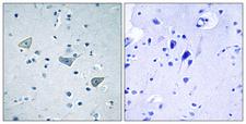 GPR158 Antibody - Immunohistochemistry analysis of paraffin-embedded human brain tissue, using GPR158 Antibody. The picture on the right is blocked with the synthesized peptide.