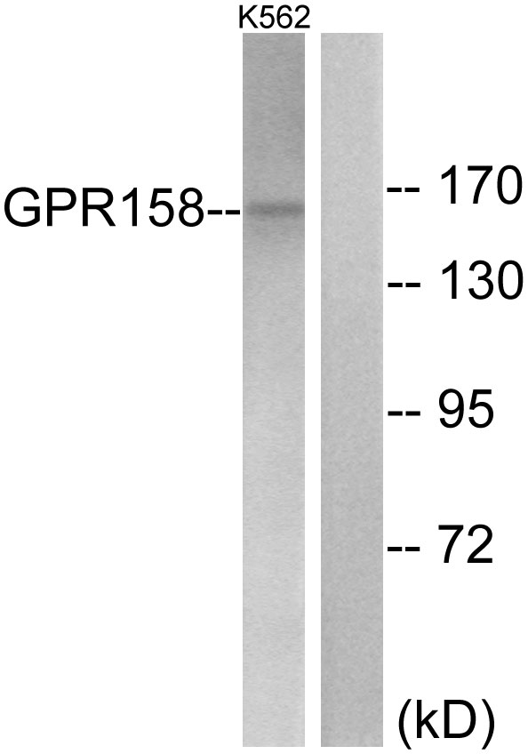 GPR158 Antibody - Western blot analysis of lysates from K562 cells, using GPR158 Antibody. The lane on the right is blocked with the synthesized peptide.