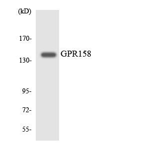 GPR158 Antibody - Western blot analysis of the lysates from HeLa cells using GPR158 antibody.