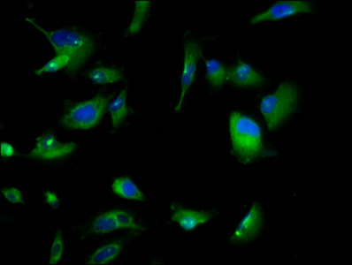 GPR158 Antibody - Immunofluorescence staining of U251 cells at a dilution of 1:166, counter-stained with DAPI. The cells were fixed in 4% formaldehyde, permeabilized using 0.2% Triton X-100 and blocked in 10% normal Goat Serum. The cells were then incubated with the antibody overnight at 4 °C.The secondary antibody was Alexa Fluor 488-congugated AffiniPure Goat Anti-Rabbit IgG (H+L) .