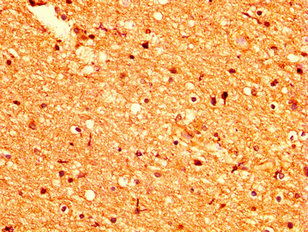 GPR158 Antibody - Immunohistochemistry image at a dilution of 1:500 and staining in paraffin-embedded human brain tissue performed on a Leica BondTM system. After dewaxing and hydration, antigen retrieval was mediated by high pressure in a citrate buffer (pH 6.0) . Section was blocked with 10% normal goat serum 30min at RT. Then primary antibody (1% BSA) was incubated at 4 °C overnight. The primary is detected by a biotinylated secondary antibody and visualized using an HRP conjugated SP system.