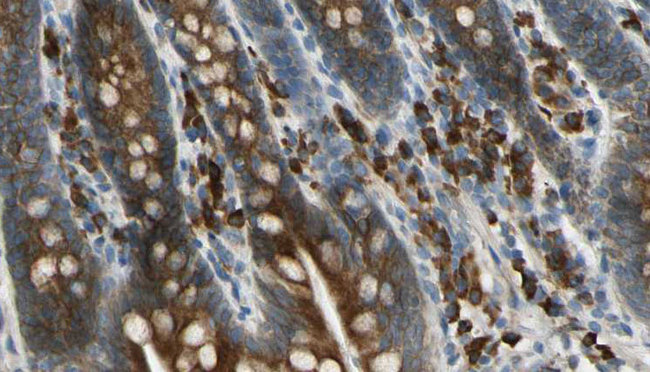 GPR158 Antibody - 1:100 staining mouse intestine tissue by IHC-P. The sample was formaldehyde fixed and a heat mediated antigen retrieval step in citrate buffer was performed. The sample was then blocked and incubated with the antibody for 1.5 hours at 22°C. An HRP conjugated goat anti-rabbit antibody was used as the secondary.