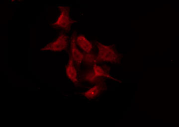 GPR158 Antibody - Staining HeLa cells by IF/ICC. The samples were fixed with PFA and permeabilized in 0.1% Triton X-100, then blocked in 10% serum for 45 min at 25°C. The primary antibody was diluted at 1:200 and incubated with the sample for 1 hour at 37°C. An Alexa Fluor 594 conjugated goat anti-rabbit IgG (H+L) Ab, diluted at 1/600, was used as the secondary antibody.