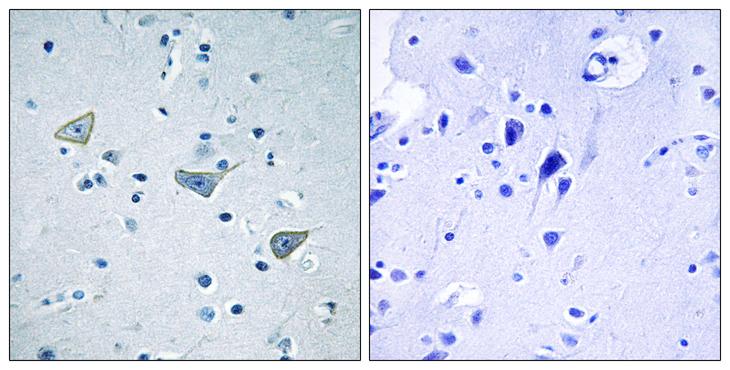 GPR158 Antibody - Peptide - + Immunohistochemistry analysis of paraffin-embedded human brain tissue using GPR158 antibody.