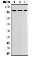 GPR158 Antibody - Western blot analysis of GPR158 expression in COLO205 (A); HeLa (B); mouse brain (C) whole cell lysates.