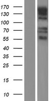 GPR158 Protein - Western validation with an anti-DDK antibody * L: Control HEK293 lysate R: Over-expression lysate