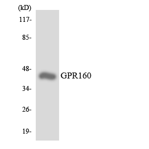 GPR160 Antibody - Western blot analysis of the lysates from HUVECcells using GPR160 antibody.