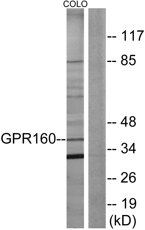GPR160 Antibody - Western blot analysis of lysates from COLO205 cells, using GPR160 Antibody. The lane on the right is blocked with the synthesized peptide.