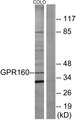GPR160 Antibody - Western blot analysis of lysates from COLO205 cells, using GPR160 Antibody. The lane on the right is blocked with the synthesized peptide.