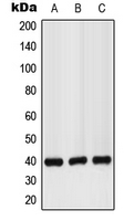 GPR160 Antibody - Western blot analysis of GPR160 expression in LO2 (A); mouse liver (B); rat kidney (C) whole cell lysates.